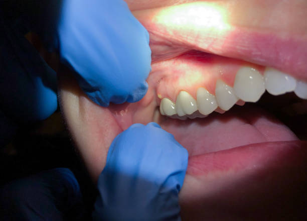 Best Emergency Treatment for Toothache in Centerville, OH