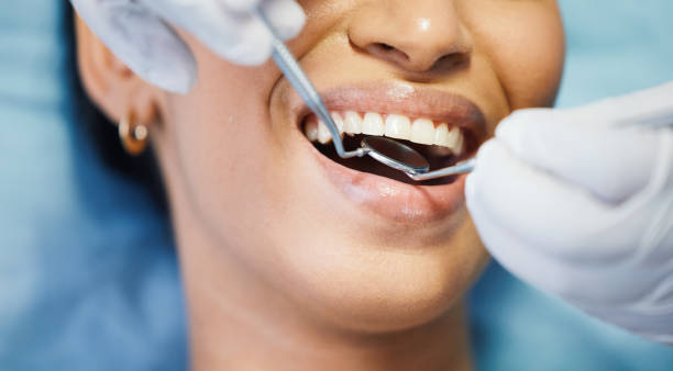 Best Emergency Broken Tooth Repair in Centerville, OH