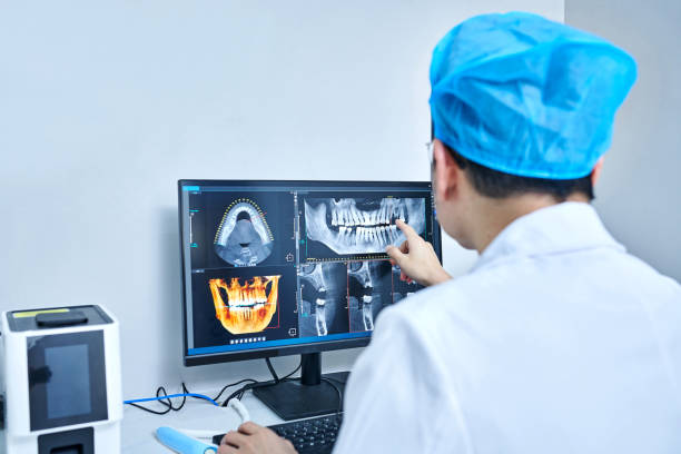 Best Emergency Root Canal Treatment in Centerville, OH